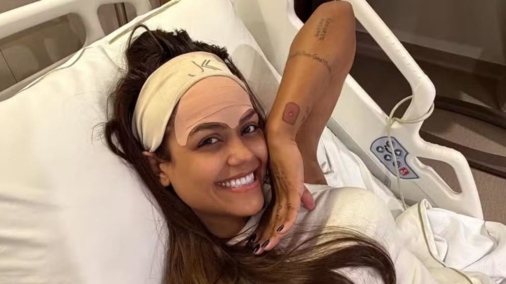 Camila Loures faz cirurgia estética para remover veia da testa e mostra resultado