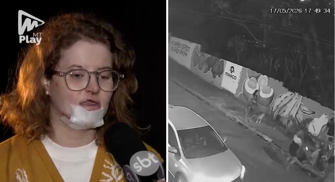 Estudante cai em bueiro em Cuiabá, sofre ferimentos no rosto e é socorrida com ajuda de moradores