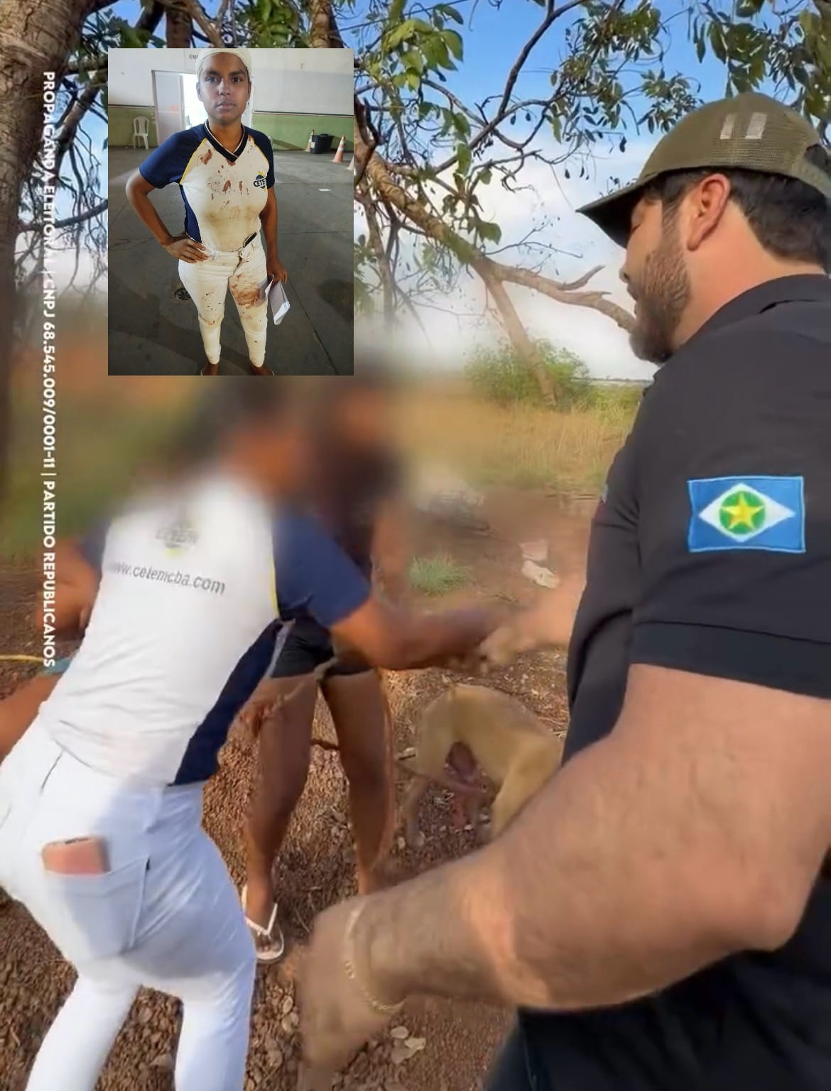 Confusão por causa de cães envolve vereador e termina com estudante ferida na cabeça em VG