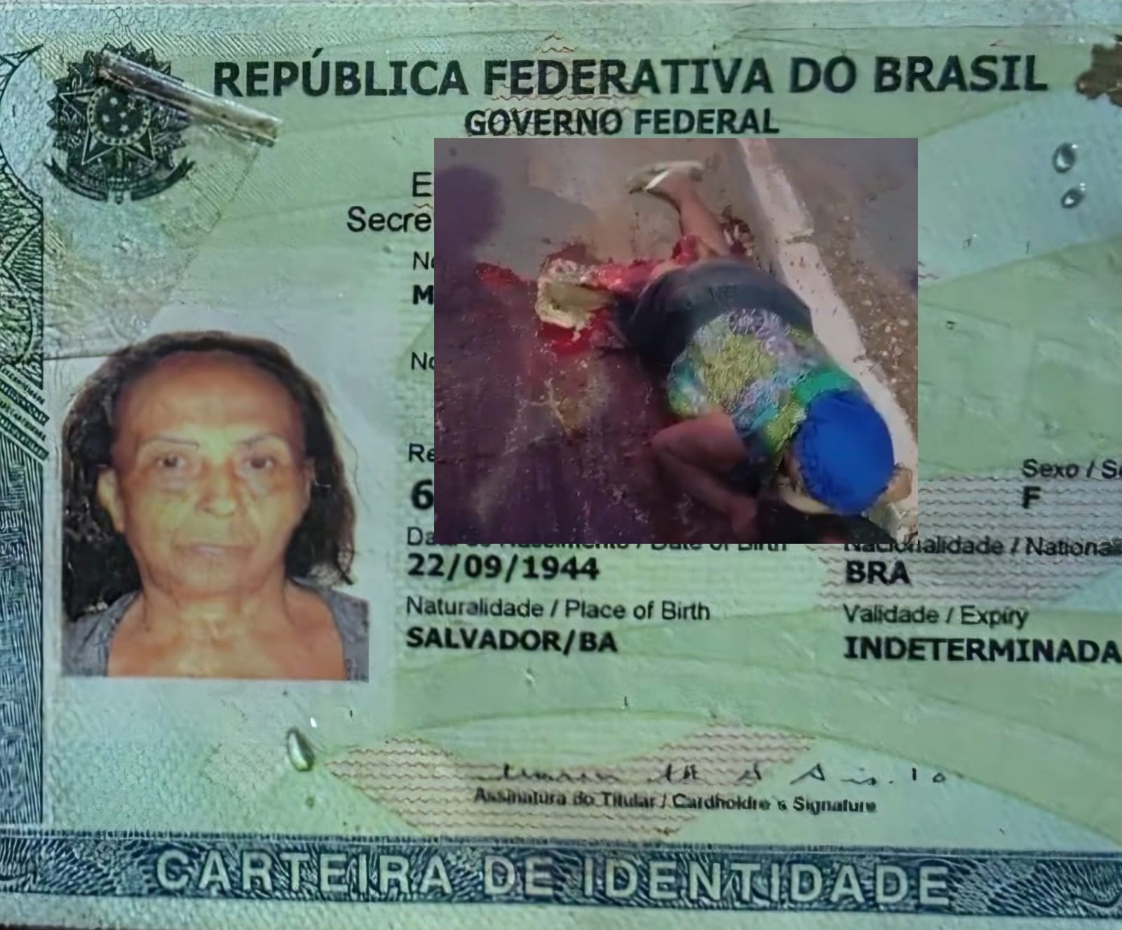 Idosa que teve perna decepada ao ser atropelada após descer de ônibus morre em Cuiabá