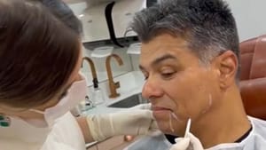 Maurício Mattar faz harmonização facial e comemora resultado natural: ‘Natural’