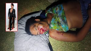 Mulher leva golpe de concreto no rosto durante briga em área de mata no interior de MT